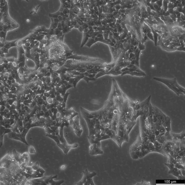 NCI-H295R Cells
