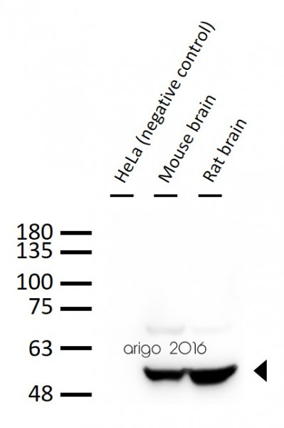 Anti-Neuron specific beta III Tubulin, clone TU-20