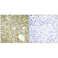 Anti-ACVRL1