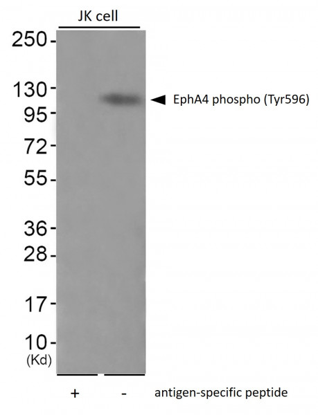 Anti-phospho-EphA4 (Tyr596)