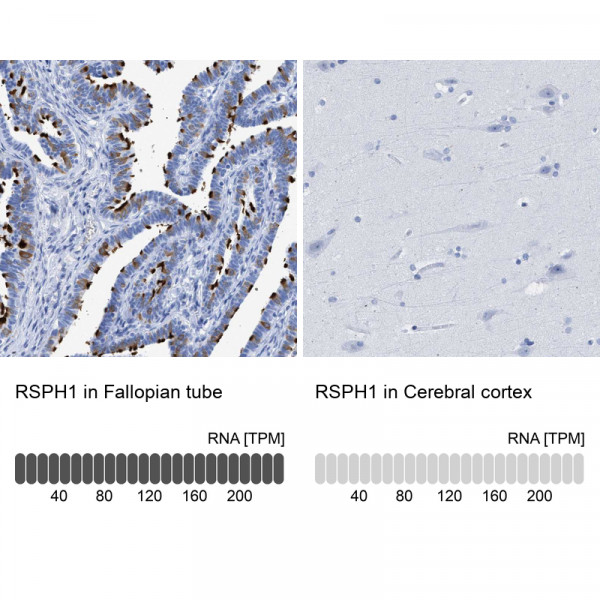 Anti-RSPH1