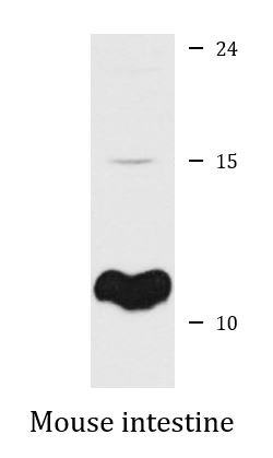 Anti-SPINK1