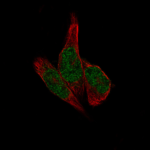 Anti-METTL14, clone CL4254