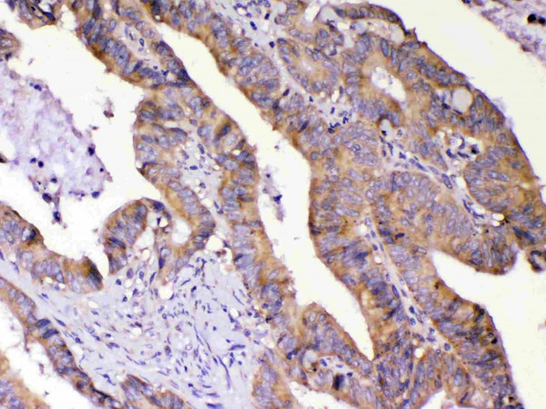 Anti-AMD1