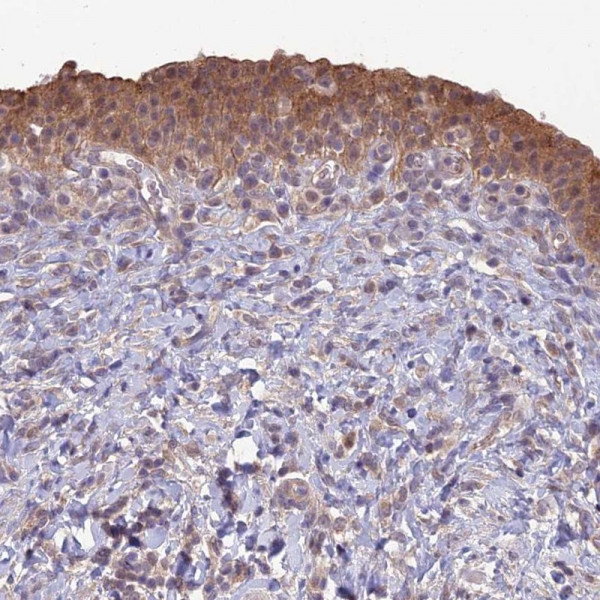 Anti-GIPC1