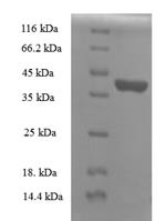 Ropporin-1B (ROPN1B), partial, human, recombinant
