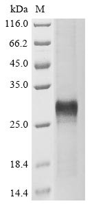 Protein Wnt-5a (WNT5A), partial, human, recombinant