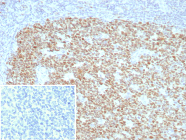 Anti-Bcl-6 (Follicular Lymphoma Marker), recombinant antibody, clone BCL6/8928R
