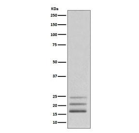 Anti-FGF2 / Fibroblast growth factor 2, clone AOHC-6