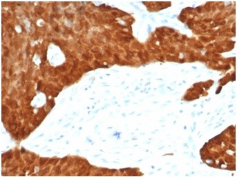 Anti-CDKN2A / p16INK4a / p14ARF, recombinant antibody, clone CDKN2A/7081R
