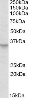 Anti-PEX2 / PXMP3, Internal