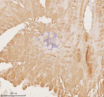 Anti-MAP4K3 / MEKKK3 / Mitogen-activated protein kinase kinase kinase kinase 3