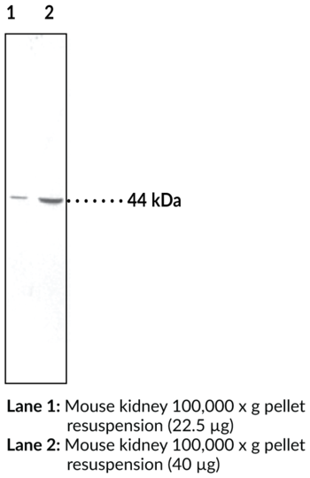 Anti-11beta-Hydroxysteroid Dehydrogenase (Type 2)