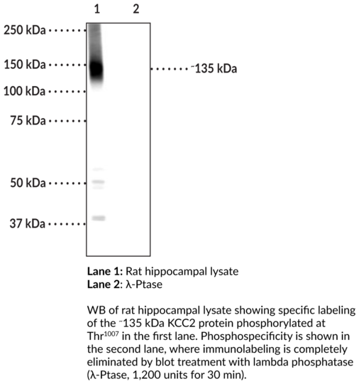 Anti-phospho-KCC2 (Thr1007)