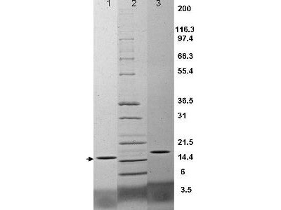 Tumor Necrosis Factor alpha, human recombinant (rHuTNF-a)