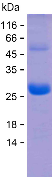 Recombinant Human NTN3 Protein