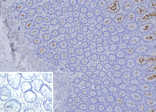 Anti-CEACAM1 (CEA Cell Adhesion Molecule 1) / CD66a, clone CEACAM1/12665