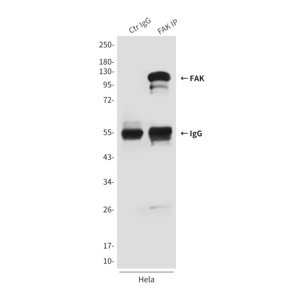 Anti-PTK2
