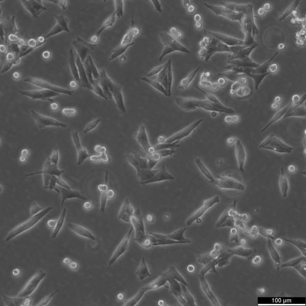 M14 Cells