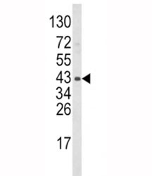 Anti-WNT5B