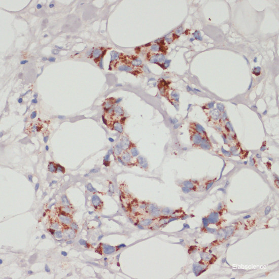 Anti-ACSL3