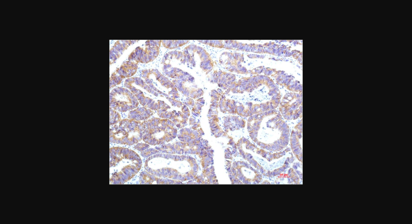 Anti-STAT1 (12E8), monoclonal