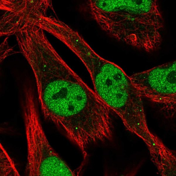 Anti-PCSK2