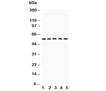 Anti-GLUT4 (Glucose Transporter 4)