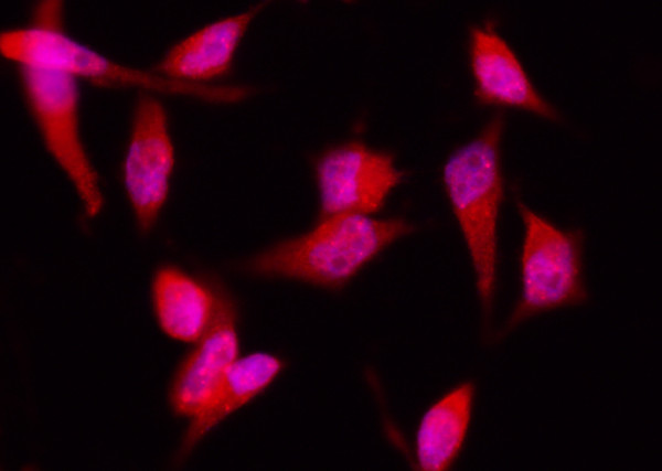 Anti-4E-BP1/EIF4EBP1 Monoclonal Recombinant Antibody