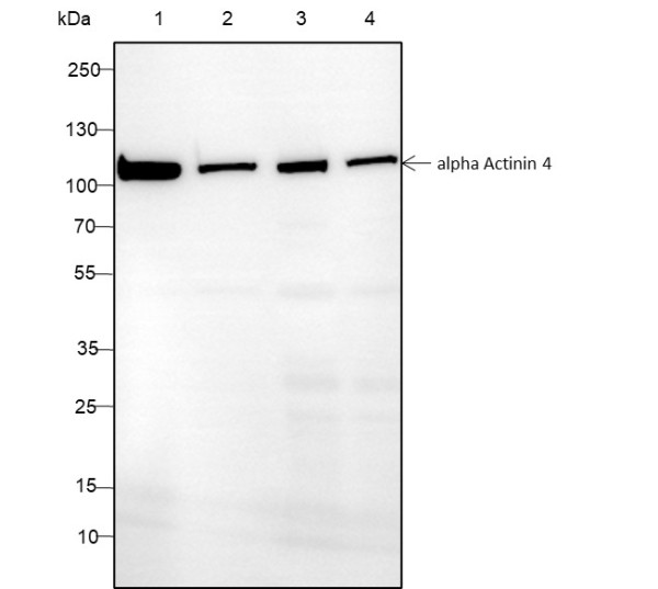 Anti-Recombinant alpha Actinin 4, clone A128