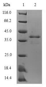 Protein S100-A8 (S100a8), mouse, recombinant