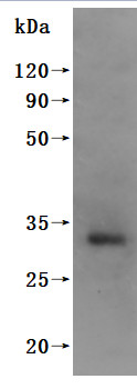 Kita-kyushu lung cancer antigen 1 (CT83)-VLPs (Active), human, recombinant