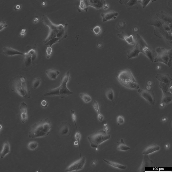 NCI-H2228 Cells