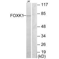 Anti-FOXK1