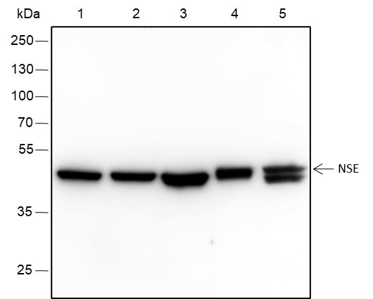 Anti-Recombinant NSE, clone A314