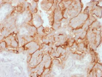 Anti-MUC16 / CA125 (Ovarian Carcinoma Marker) Recombinant Rabbit Monoclonal Antibody (clone:OCA125/2