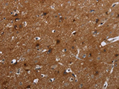 Anti-FMN2