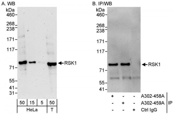 Anti-RSK1
