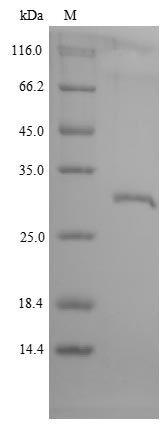 Growth hormone receptor (GHR), partial, Macaca mulatta, recombinant