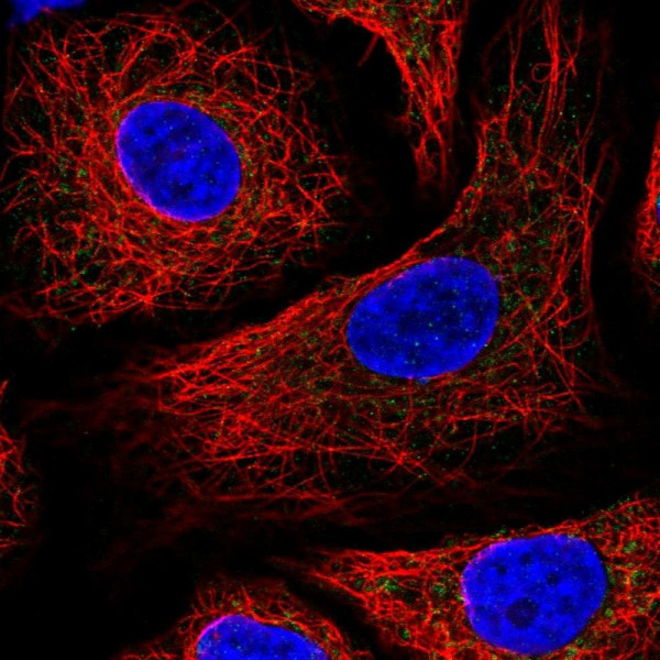 Anti-IDH3B