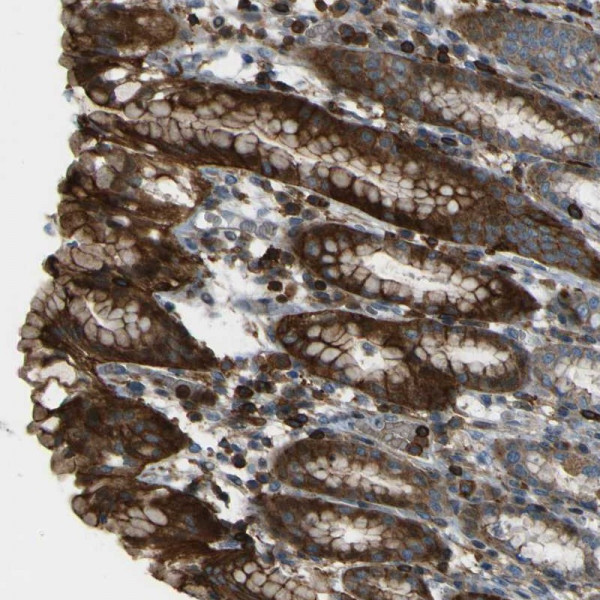 Anti-PCDHB5