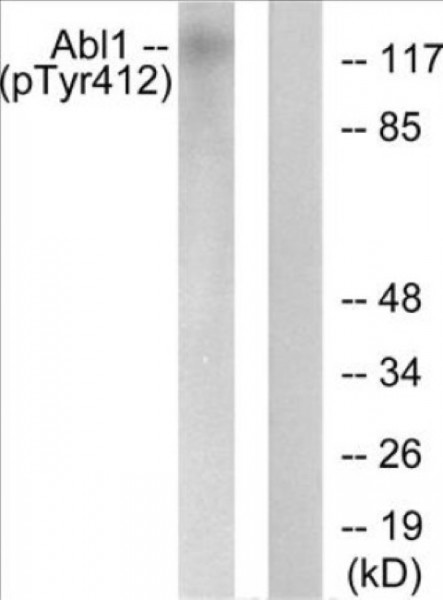 Phospho-Abl (Tyr412) In-Cell ELISA