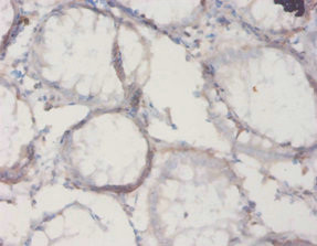 Anti-Il18bp