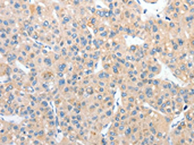 Anti-RPN1
