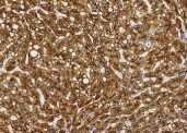 Anti-ASGPR1 Monoclonal Recombinant Antibody