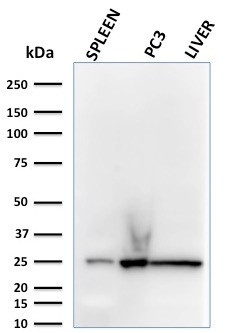 Anti-C1QA / Complement C1q A-Chain, clone C1QA/2783