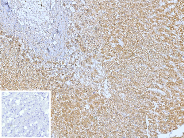 Anti-CXCR5 (Marker of T Follicular Helper (Tfh) Cells), clone CXCR5/13095