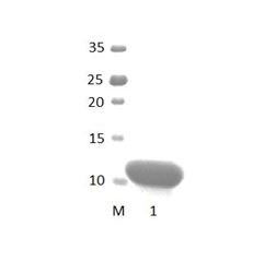 DLG5_2 PDZ Domain
