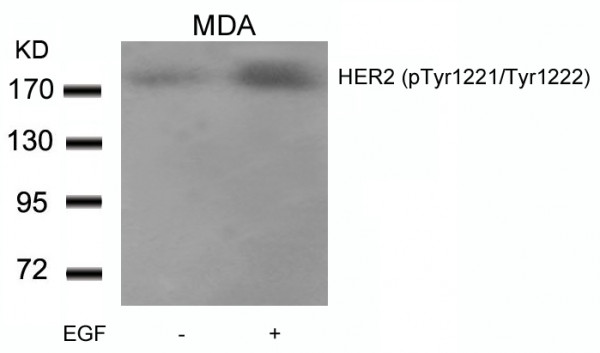 Anti-phospho-HER2 (Tyr1221/Tyr1222)