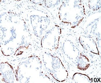 Anti-HMW Cytokeratin, clone 34BE12